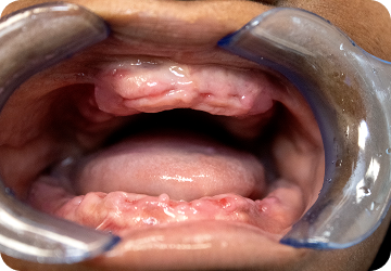 Oral health care image